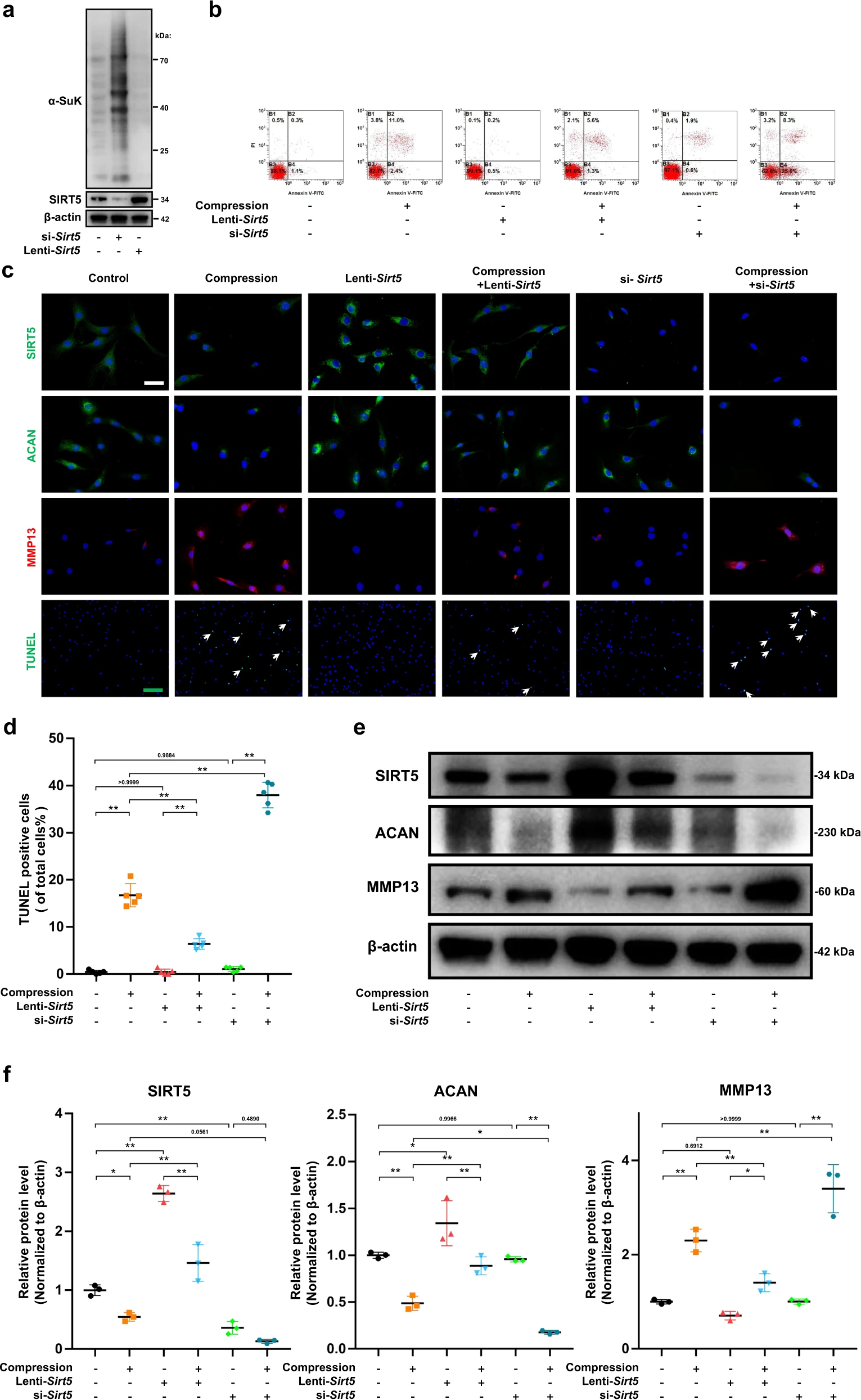线粒体蛋白Sirtuin 5 去琥珀酰化修饰通过调节线粒体稳态介导压缩诱导的椎间盘退变