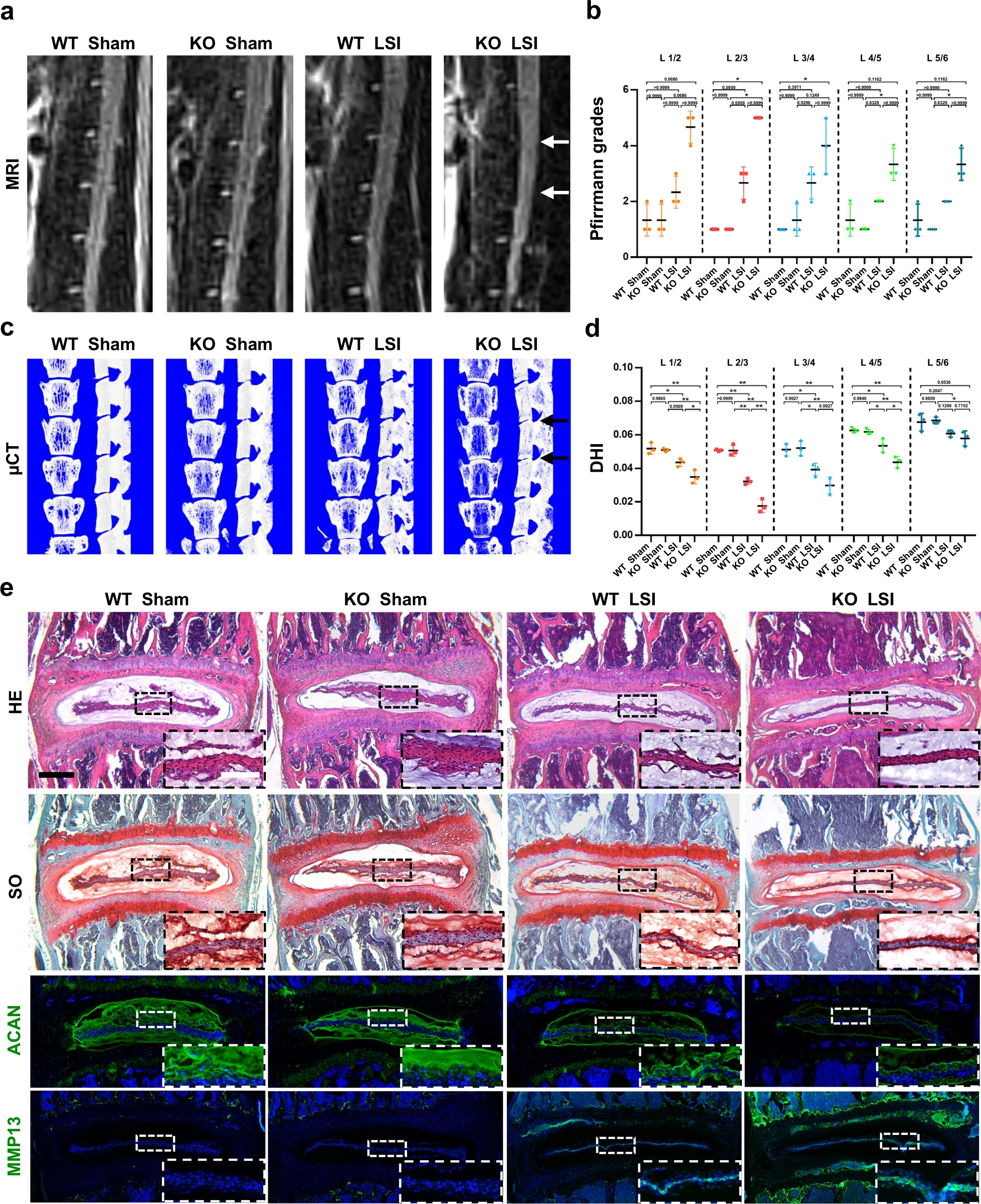 线粒体蛋白Sirtuin 5 去琥珀酰化修饰通过调节线粒体稳态介导压缩诱导的椎间盘退变