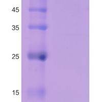 pLV3-CMV-LIAS-3×FLAG-CopGFP-Puro