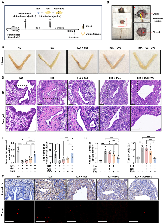 病理染色 病理染色