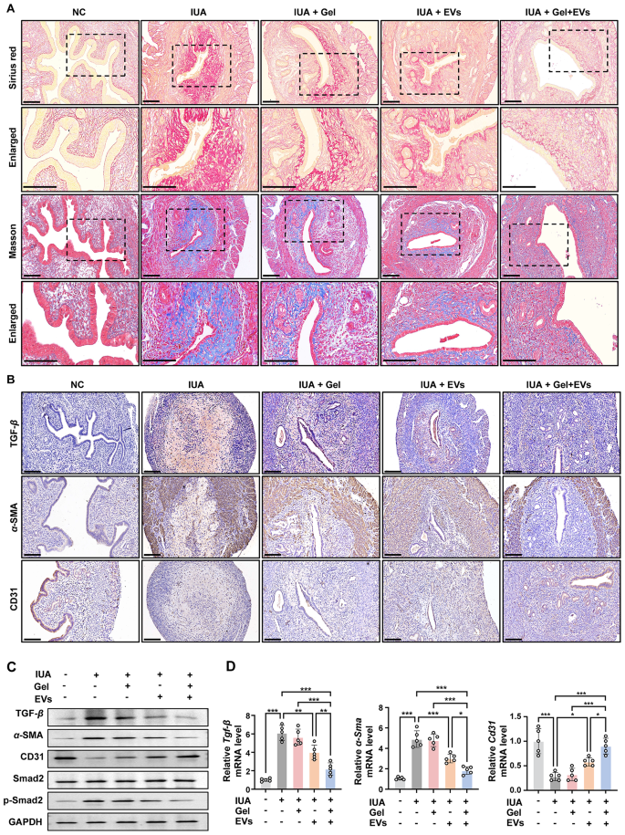 病理染色 病理染色