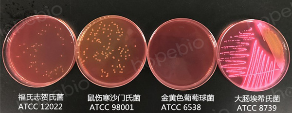脱氧胆盐柠檬酸盐琼脂培养基的使用原理及方法