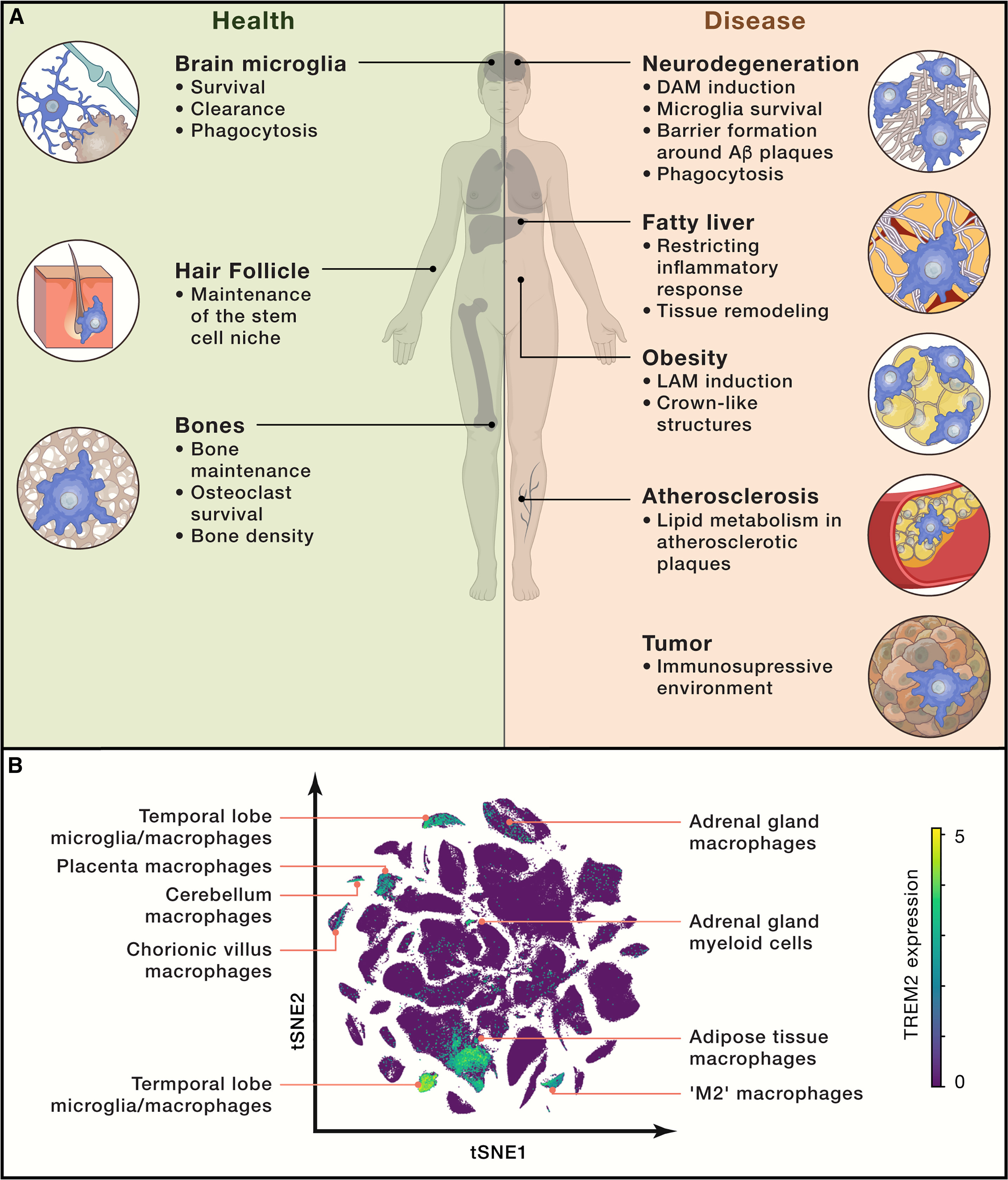 TREM2受体在多种致死疾病中起关键作用