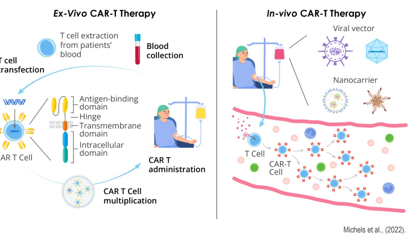 Abnova简报 | 体内CAR-T细胞在癌症治疗中的应用（一）