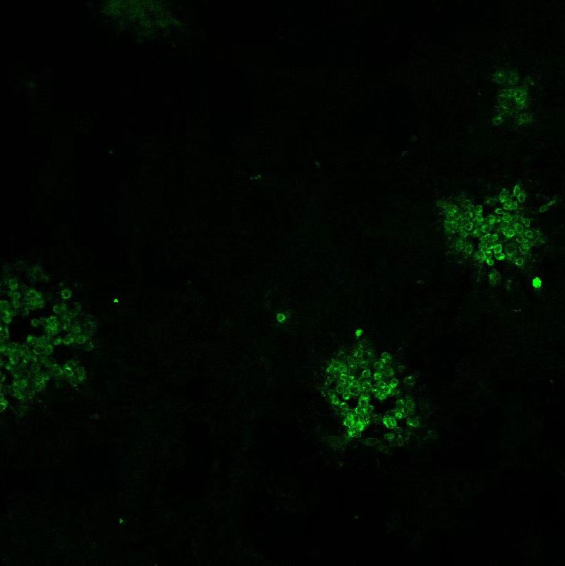 盖塔病毒E1蛋白单克隆抗体