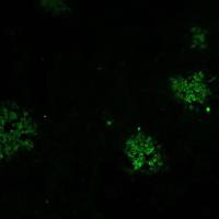 盖塔病毒E1蛋白单克隆抗体