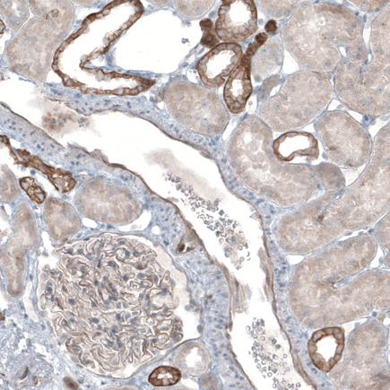 Altas热销抗体：Anti-THSD7A Antibody
