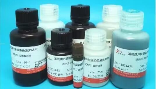 【血液细胞染色】瑞氏染色法注意事项