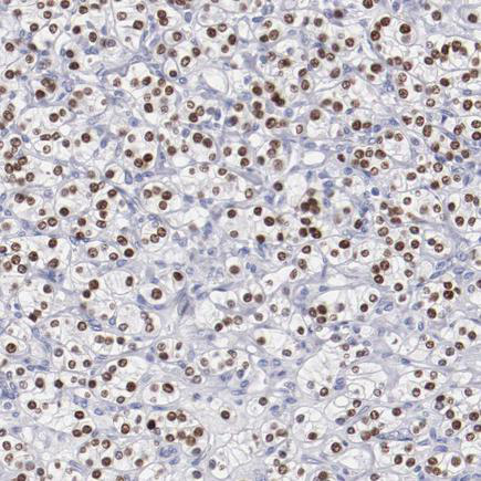 Altas Antibodies热销产品——Anti-HNF1B Antibody