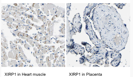 Altas热销产品——Anti-XIRP1 Antibody