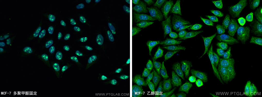 免疫荧光结果不理想，可能是固定剂和通透剂的锅！