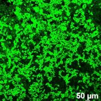猪传染性胃肠炎病毒TGEV-N蛋白单克隆抗体