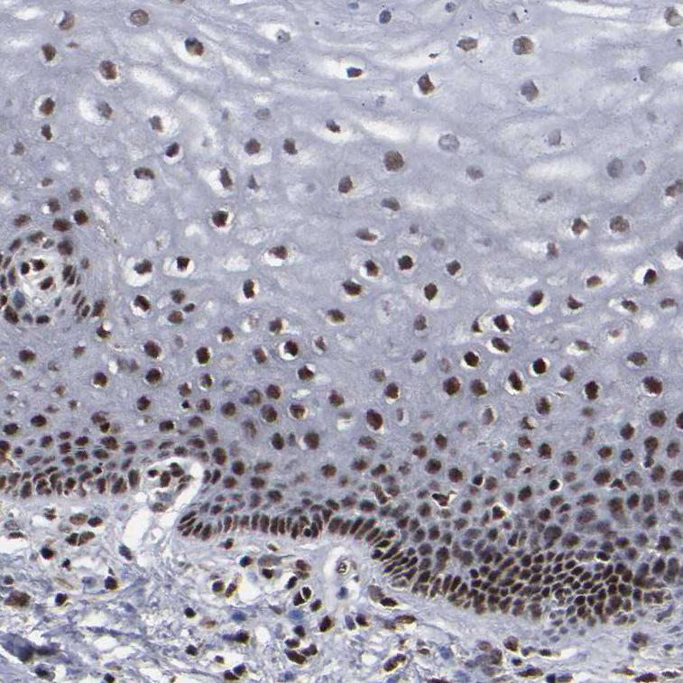 Altas Antibodies抗体：Anti-ATRX Antibody