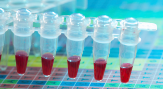 无血清培养基使用讲解