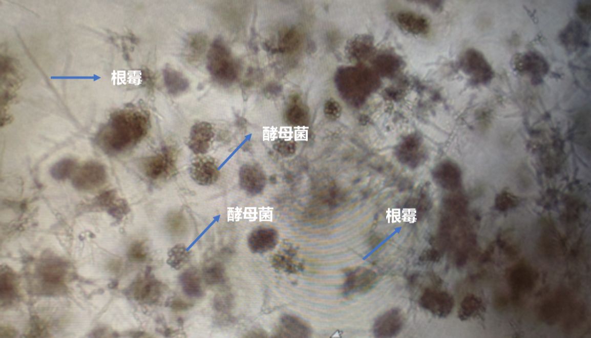 类器官污染鉴别与除菌攻略（一）