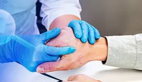 2024年世界银屑病日|华美生物助力银屑病研究与治疗新突破