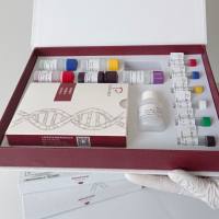 牛可溶性间皮素相关肽(SMRP)酶联免疫试剂盒