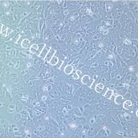 NUGC-3 | 人胃癌细胞 | NUGC-3 | NUGC-3细胞 | NUGC3细胞