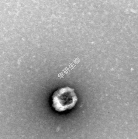 外泌体检测实验