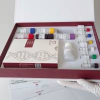 牛间皮瘤标志物/间皮素(N-ERC)酶联免疫试剂盒