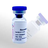 Wissen 重组人肝细胞生长因子 HGF CT-211A 10ug