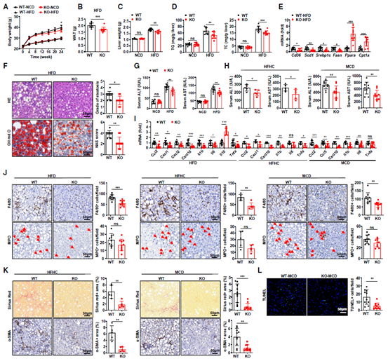 Cell Metabolism丨减轻代谢功能障碍相关脂肪性肝病的关键蛋白找到了！