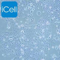 MS751 人子宫颈表皮癌细胞/STR鉴定/镜像绮点（Cellverse）