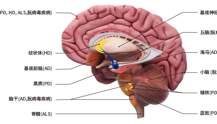 揭秘大脑中的隐形杀手：神经退行性疾病