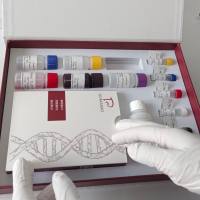 牛成纤维细胞生长因子18(FGF18)酶联免疫试剂盒