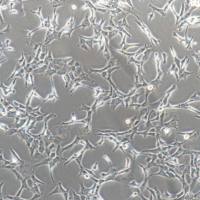 BCPAP、BCPAP细胞、BCPAP细胞、BCPAP、人甲状腺癌细胞（乳头状）/STR鉴定/镜像绮点（Cellverse）