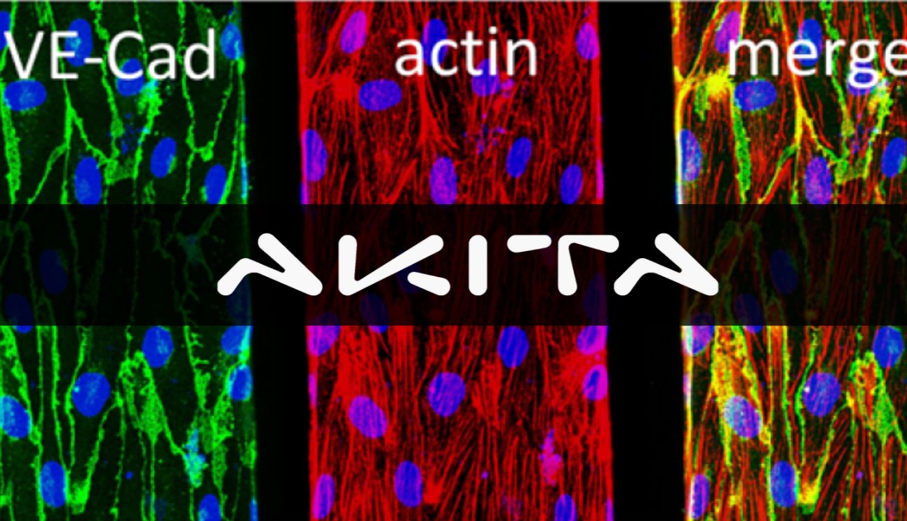 AKITA 3D血管模型1 | 静脉畸形（VMs）_曼博生物代理