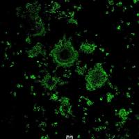 猪流行性腹泻病毒PEDV-N蛋白单克隆抗体