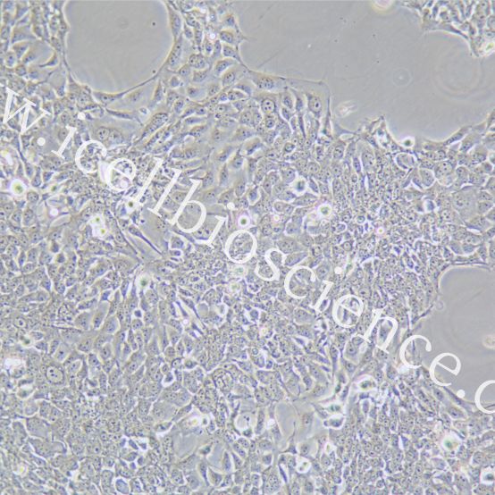 KYSE-140 |KYSE-140细胞|KYSE140|KYSE140细胞|KYSE140人食管鳞癌细胞/STR鉴定/镜像绮点(Cellverse)