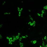 犬瘟热病毒单克隆抗体