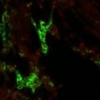 萨佩罗病毒VP1蛋白单克隆抗体