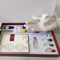 牛总胆汁酸(TBA)酶联免疫试剂盒