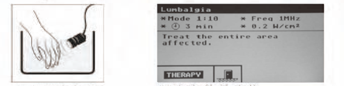 超声物理治疗仪