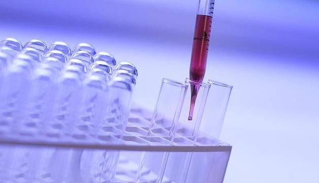 NGS检测流程的核酸提取注意事项