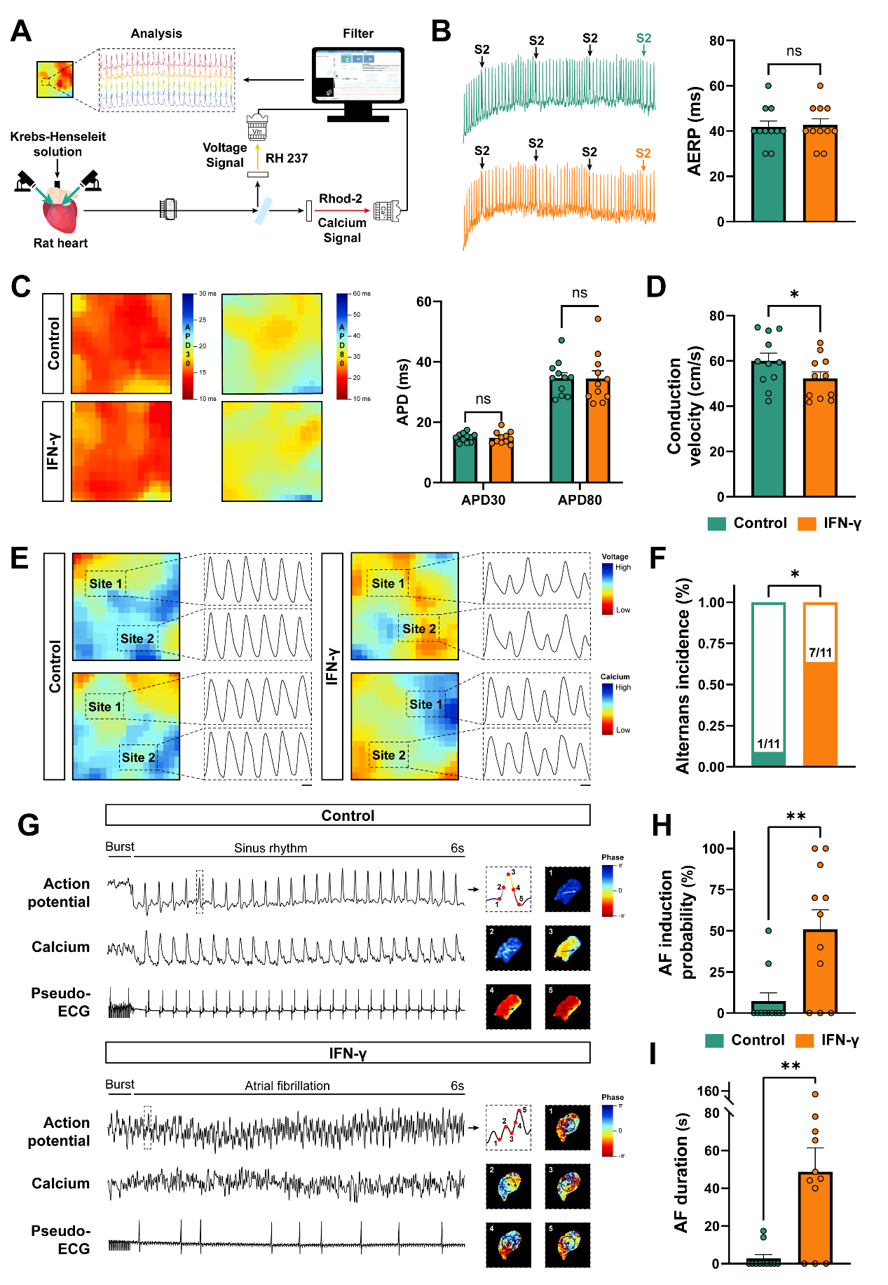 衰老的 CD8+ T细胞:心房颤动的一个新风险因素