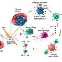 纳米颗粒（脂质体、PLGA纳米粒、无机纳米颗粒）被NK细胞膜包被