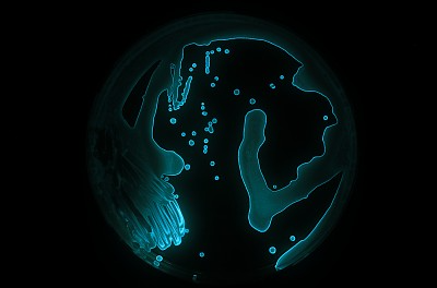 微生物内毒素检测方法