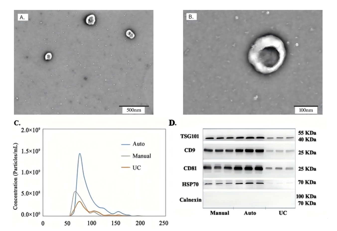 外泌体全自动提取仪(EVrich)