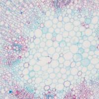 番红-固绿病理染色