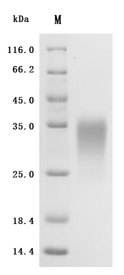 CSB-MP001260HU1 SDS-PAGE