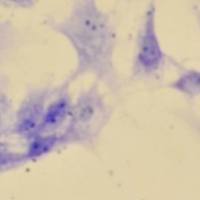 甲苯胺蓝病理染色