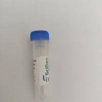 KD-Validated Anti-Androgen receptor Rabbit Monoclonal Antibody