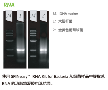SPINeasy™ 细菌总RNA提取试剂盒，含裂解介质B