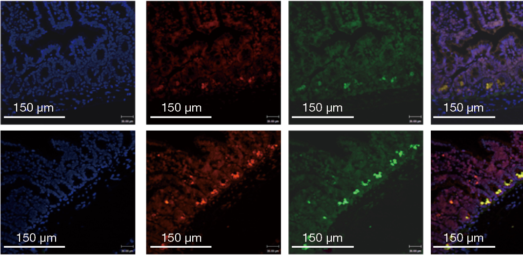 直接荧光标记细菌 FISH探针总结