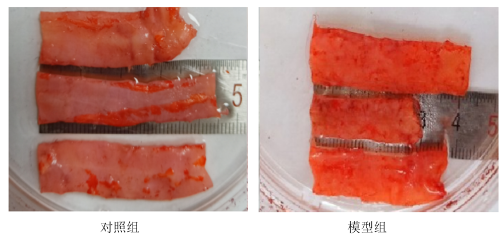 动脉粥样硬化模型