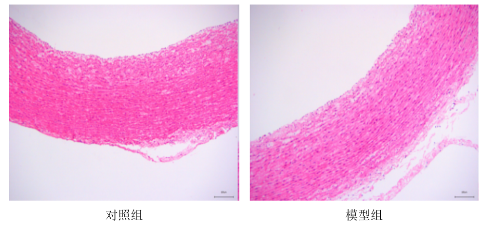 动脉粥样硬化模型